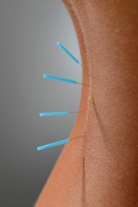  Naturheilpraxis Göttingen